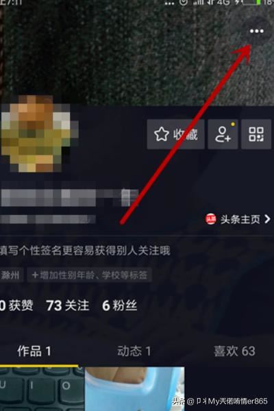 抖音怎么綁定今日頭條賬號(hào)？