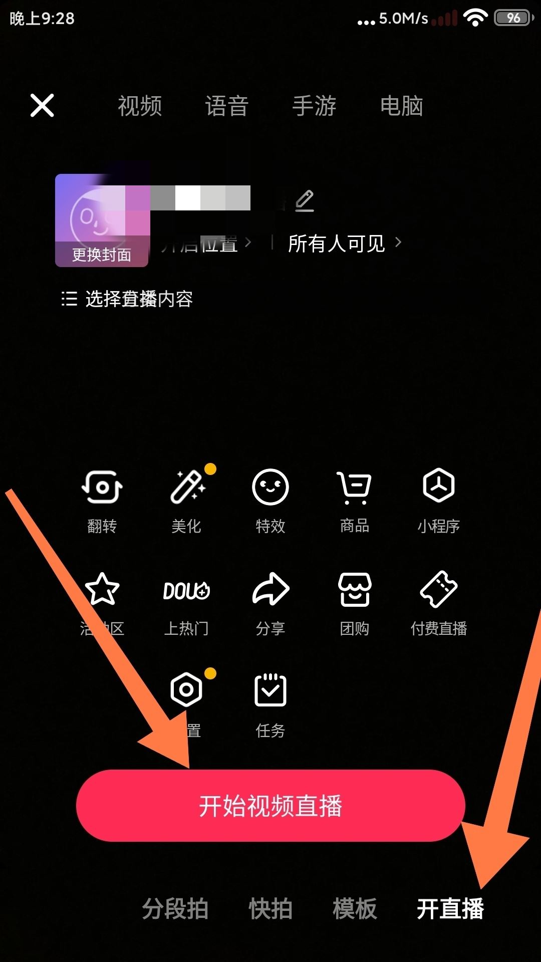 抖音直播唱歌伴唱怎么弄的？