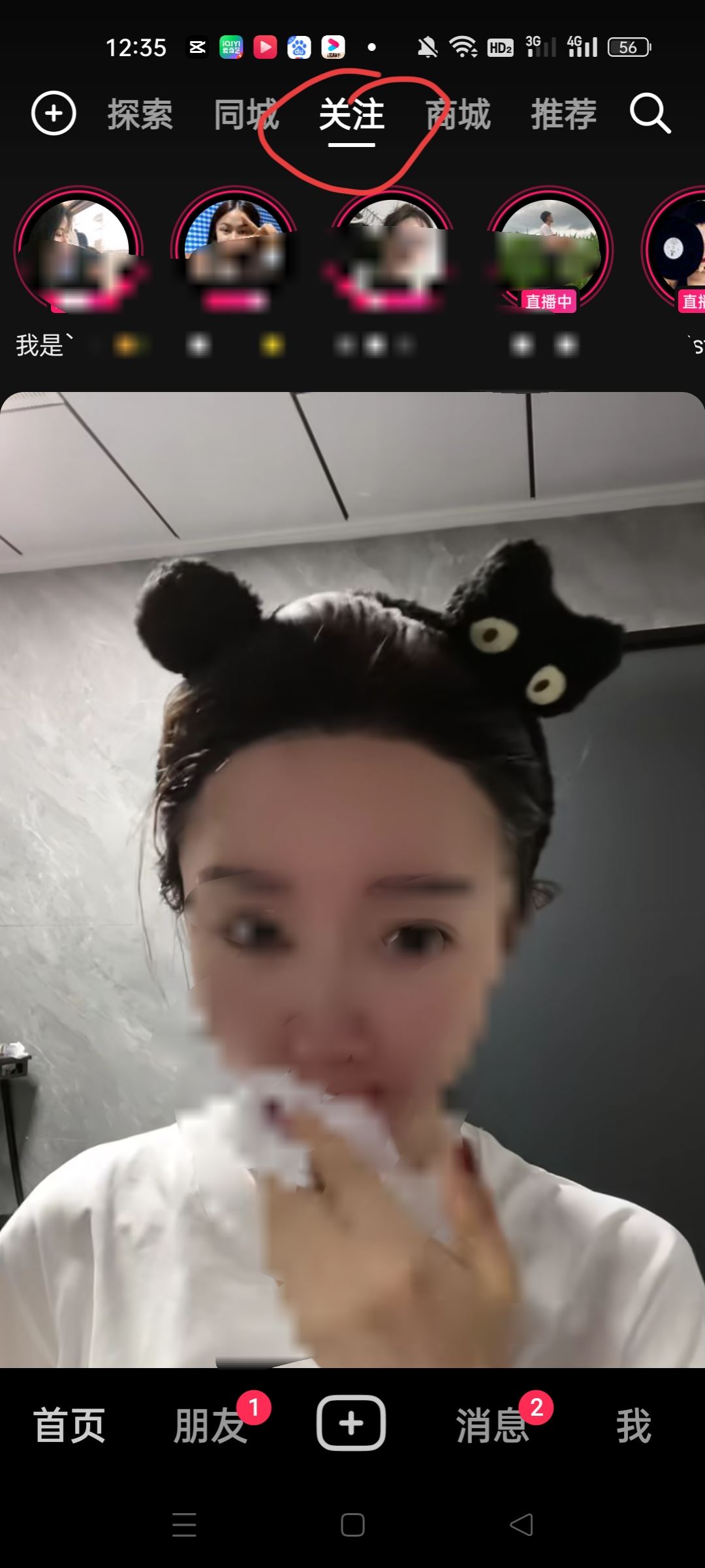 抖音關(guān)注欄不見了怎么辦怎么恢復(fù)？
