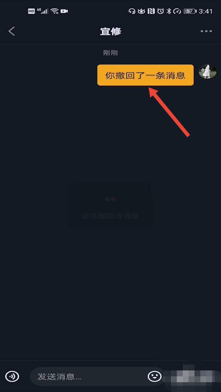 抖音分享怎么撤回？
