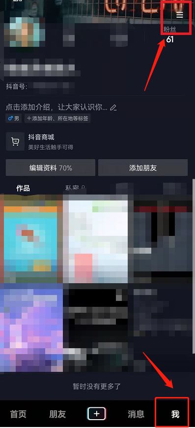 怎么把抖音和相冊的同步關(guān)掉？