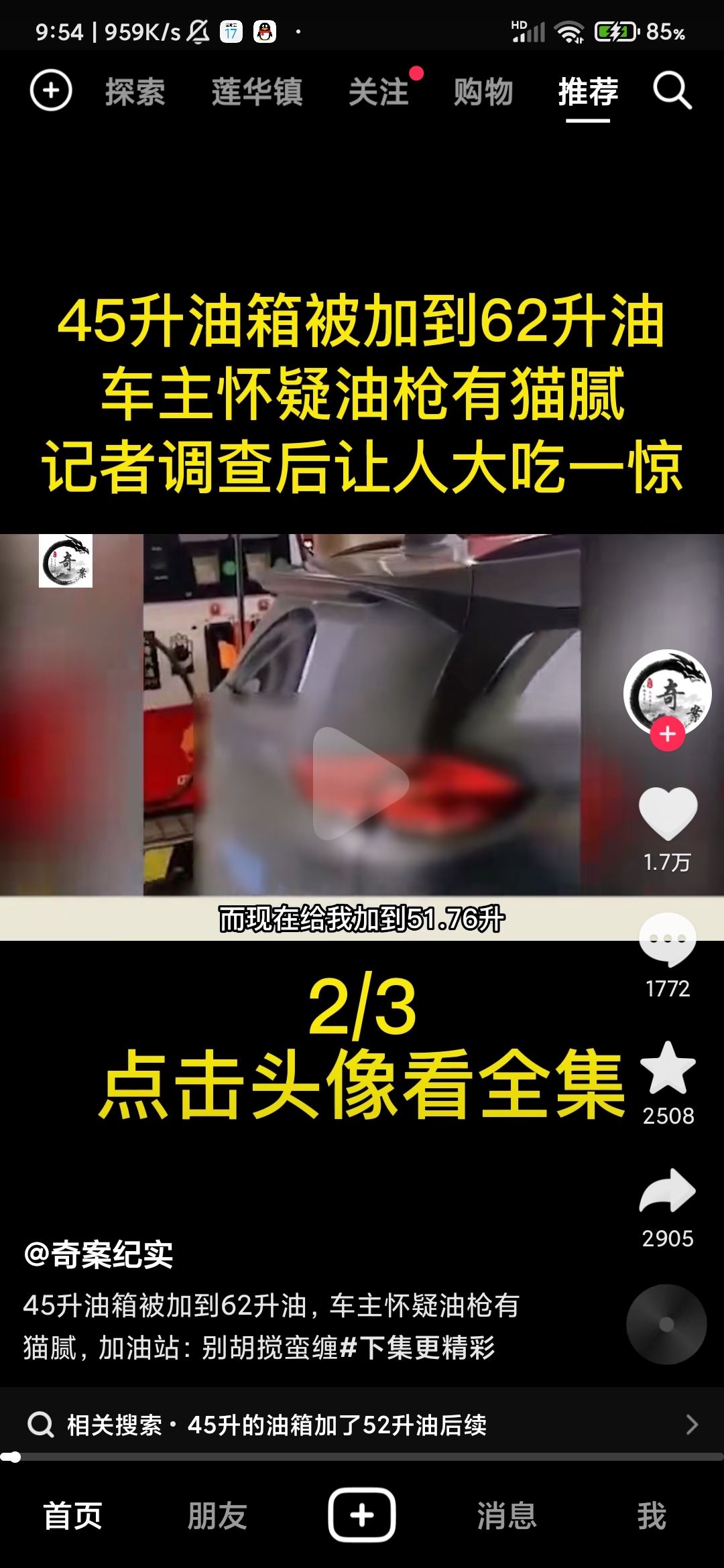 抖音頭像上快進(jìn)按鈕怎么設(shè)置？