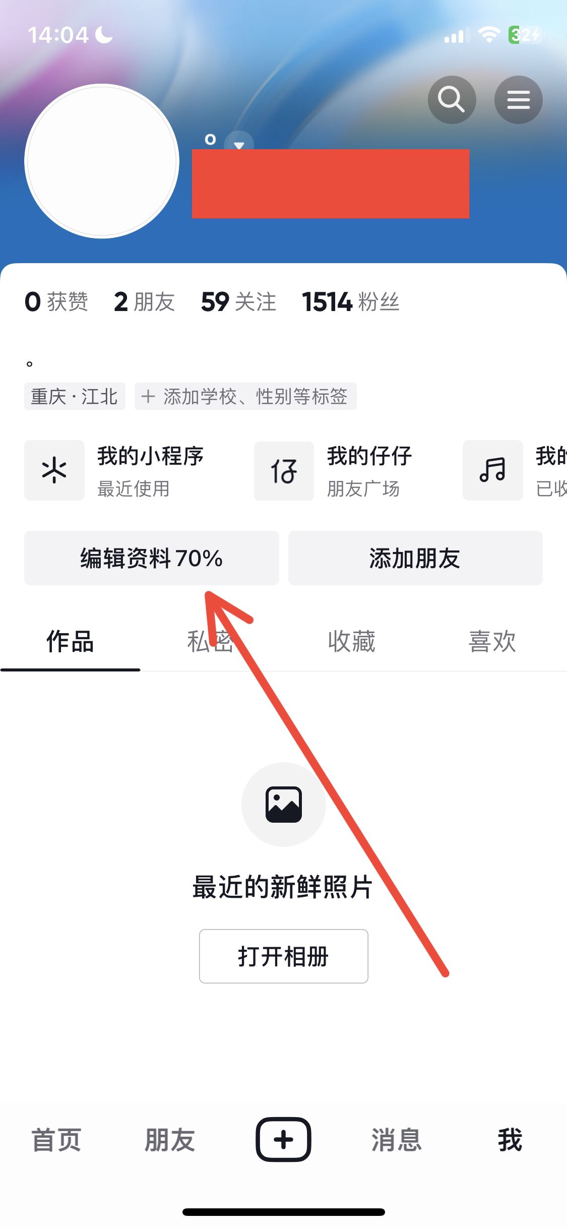 抖音30天只能修改4次名字怎么解除？