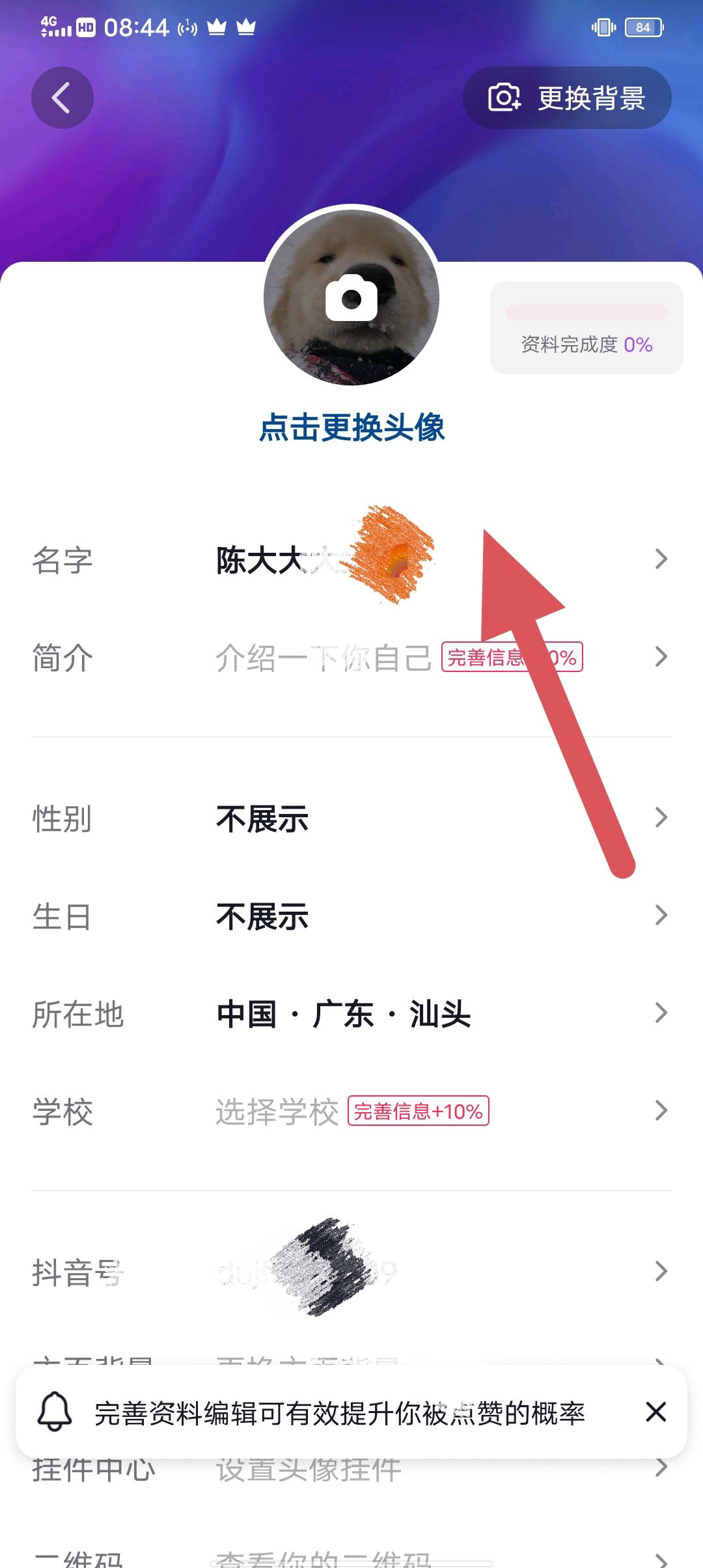 抖音30天只能修改4次名字怎么解除？
