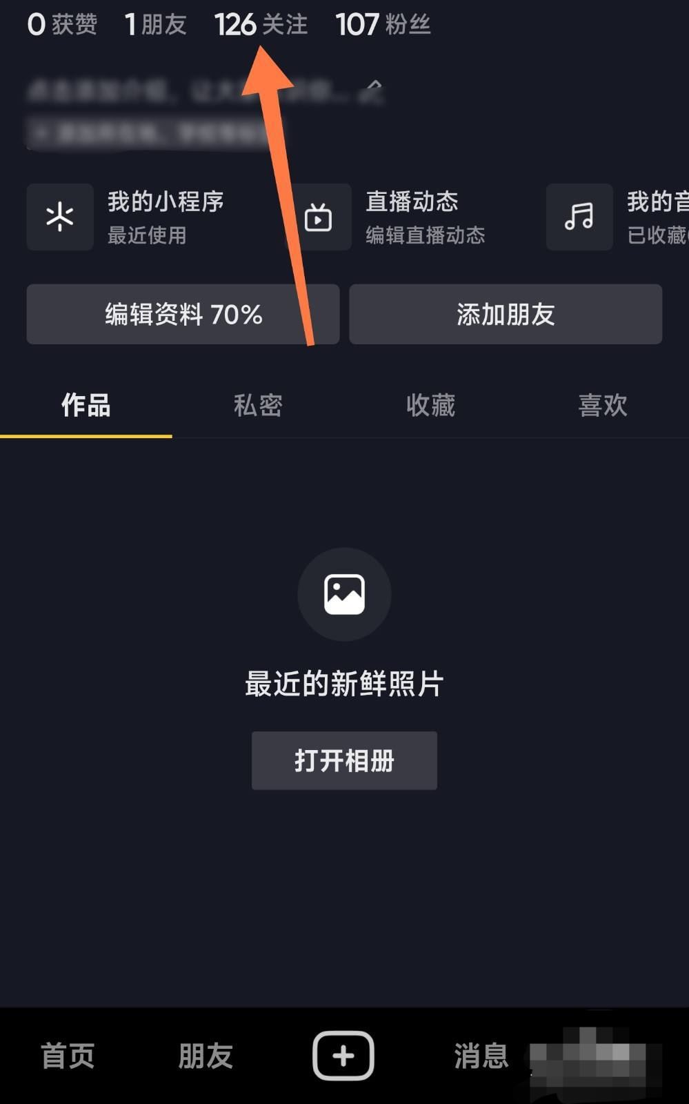 抖音特別關(guān)心怎么設(shè)置？