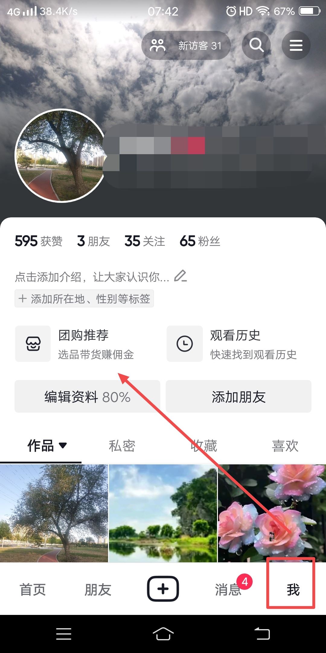 怎么轉發(fā)抖音團購鏈接？