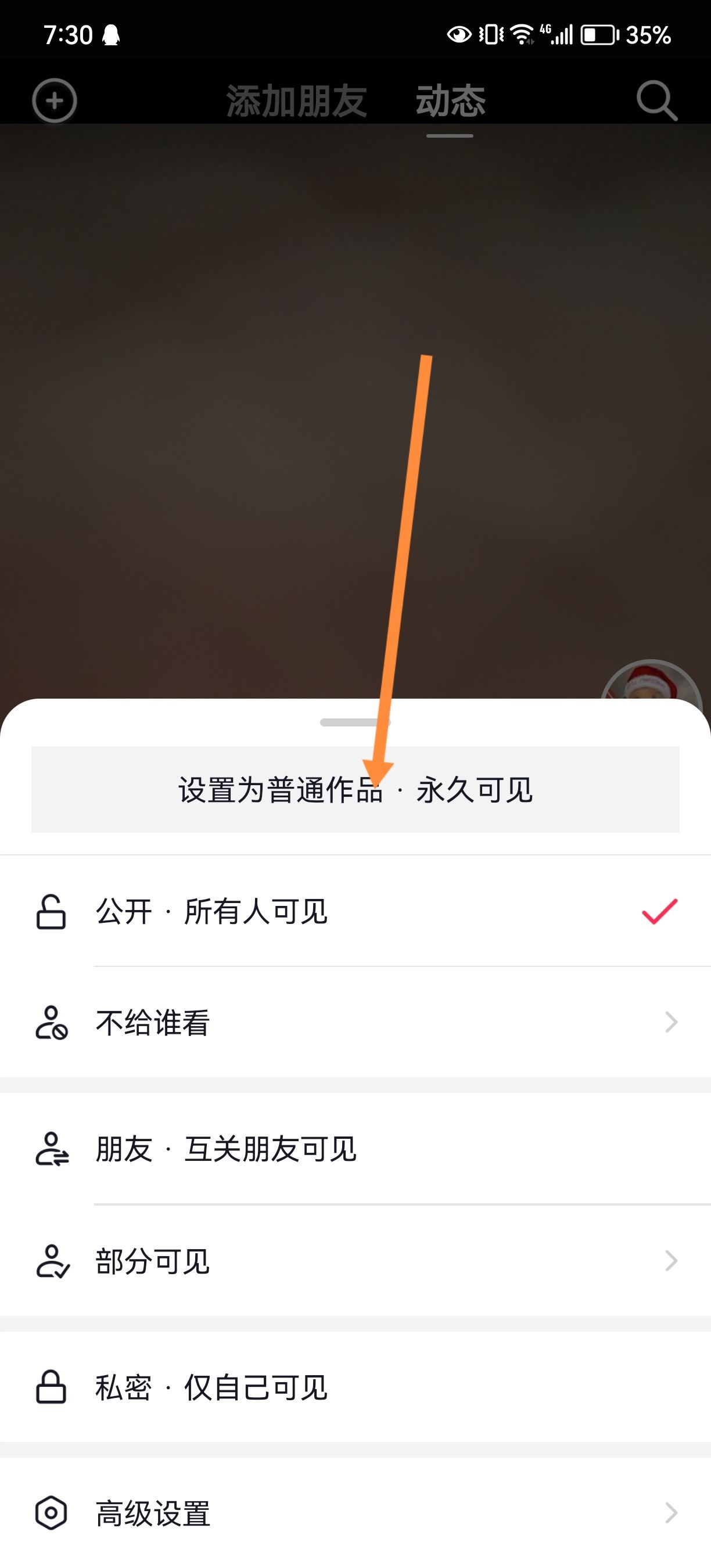 抖音發(fā)的日常怎么轉(zhuǎn)成永久？