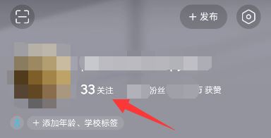 頭條如何添加抖音好友？